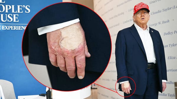 President Trump Successfully Covers "Starland Vocal Band" Tattoo
